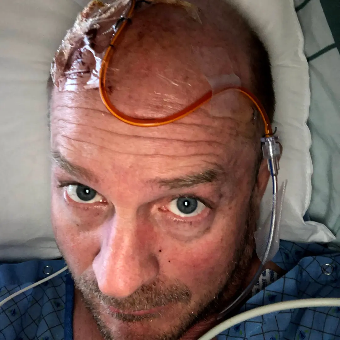 Right after brain surgery #1